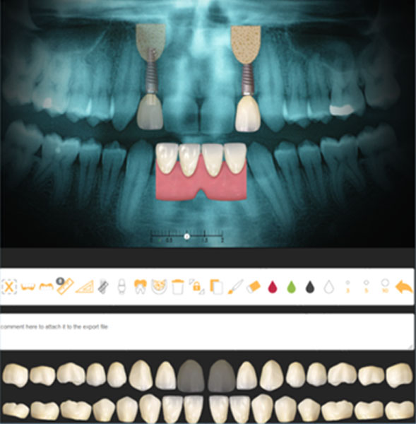 teeth xray photo 1