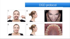 dsd-protocol