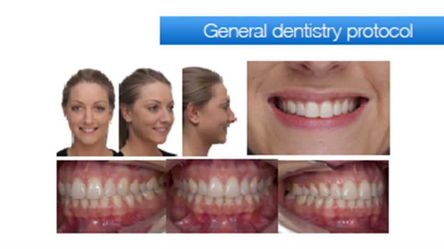 general-dentistery-protocol