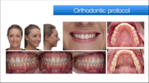 orthodontic-protocol