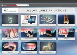 dental animation implant procedure